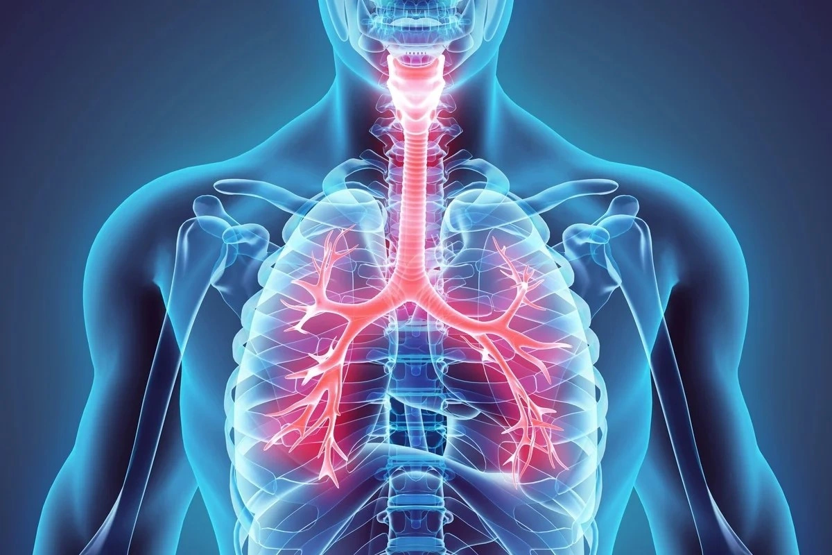 Respiratory Disorders